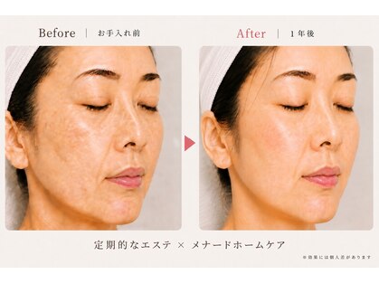 ビューネット(BEAUNet)の写真