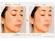 ビューネット(BEAUNet)の写真