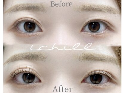 イチル(ichill)の写真