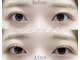 イチル(ichill)の写真