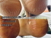 リボディハウス(ReBodyHouse)の雰囲気（最新韓国式足裏角質ケアS-PLANING※一回の施術例）