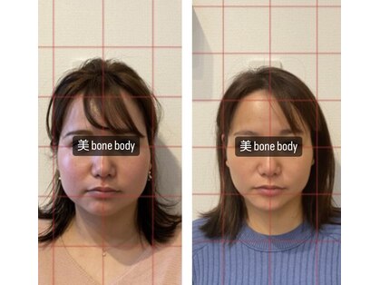 ビボーン ボディ(美bone body)の写真