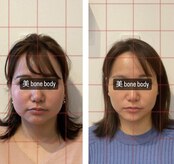 ビボーン ボディ(美bone body)