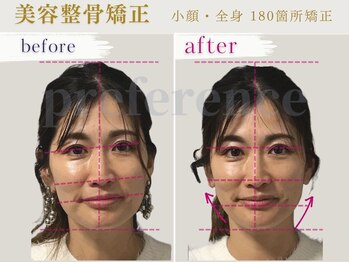 プレフェランス(Preference)/ヘッドスパ/小顔/マッサージ