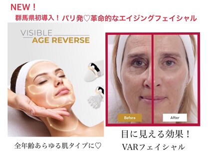 リュミエールボーテの写真