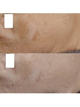 ヴェルシック(Belchic)/目の下のケアにもおすすめ