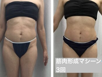 Hb 与野/基礎代謝アップ筋トレマシーン