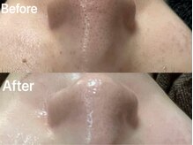 プライベート空間で他人の目を気にせずリラックス♪お子様同伴◎