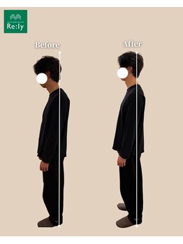整体院 リリー(Re:ly)/Before After！