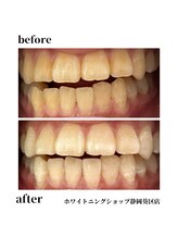 ホワイトニングショップ 葵区静岡駅店/ホワイトニング店ホワイトニング