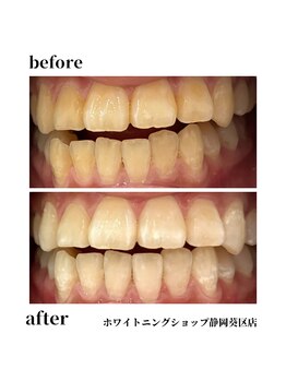 ホワイトニングショップ 葵区静岡駅店/ホワイトニング店ホワイトニング