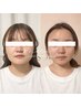 【毛穴エクストラクション＆デコルテマッサージ】綺麗と癒し欲張りエステ75分