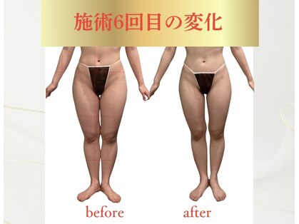 ルノン(LUNON)の写真