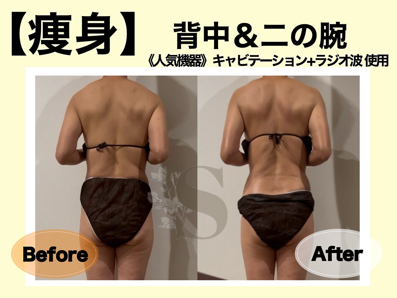 新品未使用STELLA ステラ ダイエット 【公式通販】