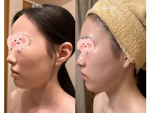 アンジュ/【レモンボトル】導入！