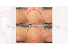 ツヤ肌オーダーメイドフェイシャル：40代1度での変化