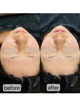 トゥインクル(Twinkle)/小顔×艶肌