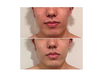 バルディーナ(BALDINA)の写真/清潔感はお肌から★男性特有の肌質へアプローチ！ホームケアまでアドバイス◎周りと確実に差がつく肌印象へ