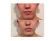 バルディーナ(BALDINA)の写真/清潔感はお肌から★男性特有の肌質へアプローチ！ホームケアまでアドバイス◎周りと確実に差がつく肌印象へ