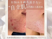 シュエマ(CHOUEMA)/［改善型特殊化粧品使用］肌変化