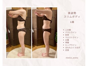 リトリコ アロマ(ritorico_aroma)の写真/【1回でこの変化】猫背・ぽっこりお腹もスッキリ！バザルト＆温熱ハンドで魅せる美姿勢スリムボディへ