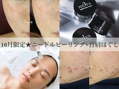 ランプ(LAMP)の写真