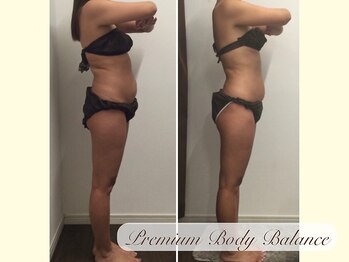 美プレミアム 越谷店/ ２０、施術結果