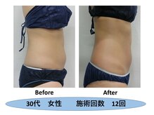 フェリス.ディア(Feliz.Dia)/【ビフォーアフター1】