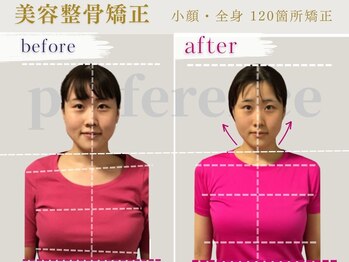 プレフェランス(Preference)/小顔/コルギ/ヘッド/整体/リンパ