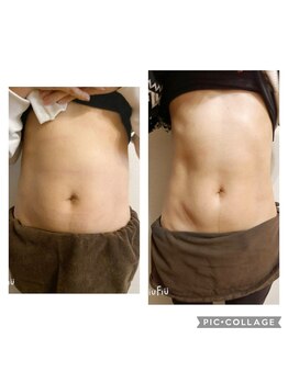 絢香/ビフォーアフター！！