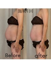 アカアカ('AKA'AKA)/15周からのマタニティケア