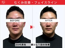 顔ジム 麻布店/20代ビジネスマン必須の小顔効果