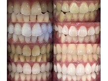 セルフメイド 福井店の雰囲気（歯科医提携セルフホワイトニングも人気！今年こそしっかり白く！）