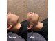 アスティ(ASTY)の写真
