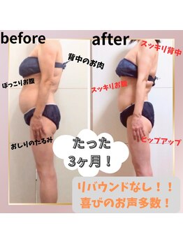 ヨサパーク マナ(YOSA PARK MANA)の写真/短期集中で見た目激変！努力はサロン通いのみ！浮腫撃退し、理想のスリムボディを目指しませんか？★