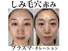 トータルエステティック ジョワイユ(JOYEUX)