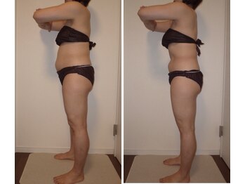 ロワフーレ/LCFテクニック