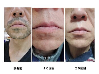 メンズ シンバ(SIMBA)/☆ ビフォーアフター ☆