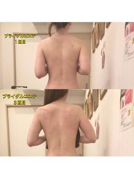 ディア スプリーマ/速効★ブライダルエステ結果出し