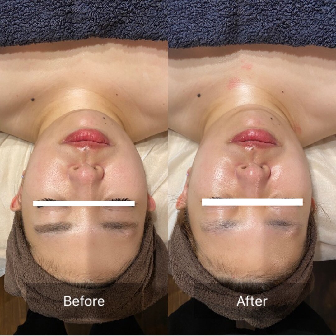 眠れる小顔コルギ