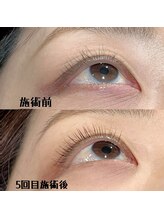 ジョワ(Joie)/マイラミネーション