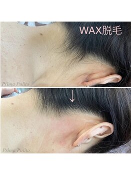 プリマプリート 岐阜店/WAX脱毛
