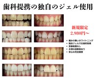 ホワイトニングショップ 大宮店