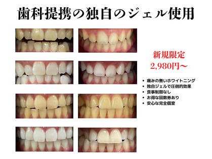 ホワイトニングショップ 大宮店の写真