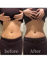 ラヴィサンスパ(Ravissant spa)/腸セラピー/腸もみ