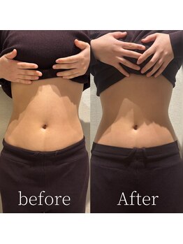 ラヴィサンスパ(Ravissant spa)/腸セラピー/腸もみ