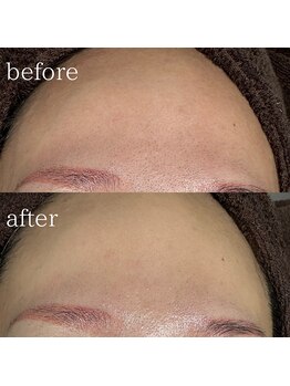 エメリーヌ(AIMELINE)/艶肌WAX +アンストレスマスク