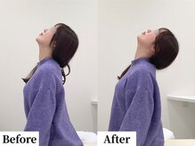 ソレア(Solea)/首こり改善1回目