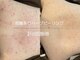 ライフサロン 天神(Life Salon)の写真