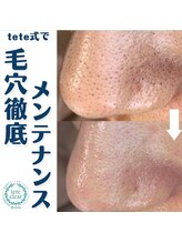 ジェリー(JERRY)/月１メンテナンス